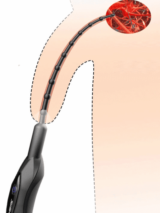 10X Vibrating Penis Head Teaser with Urethral Sounds 10X Vibrating Penis Head Teaser with Urethral Sounds